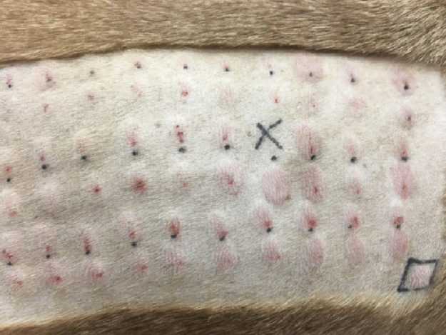 Atopic Dermatitis