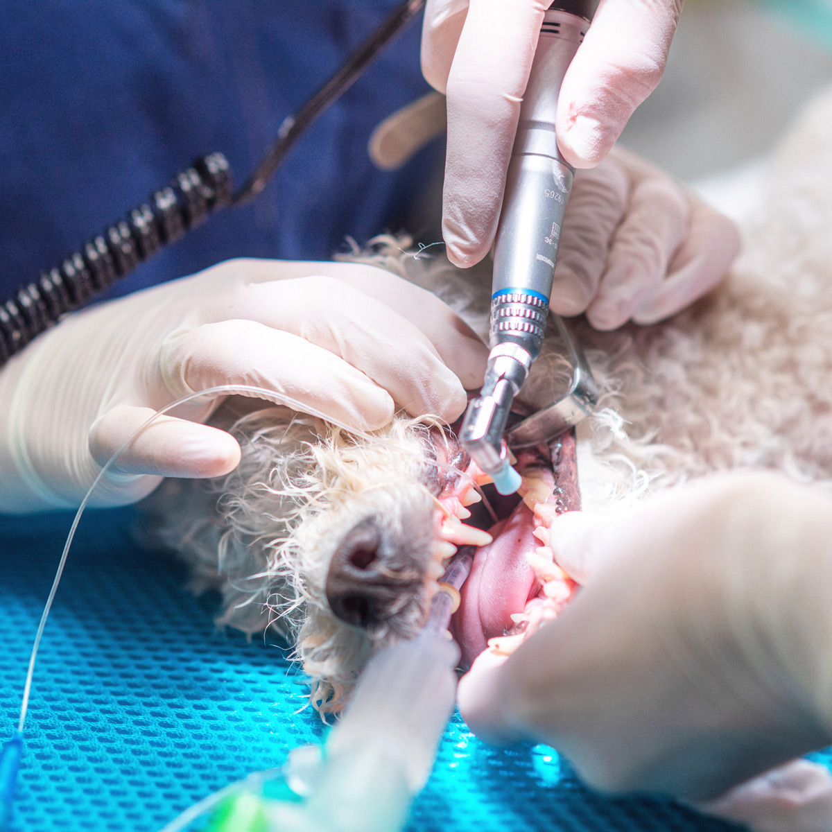 Dental Extractions