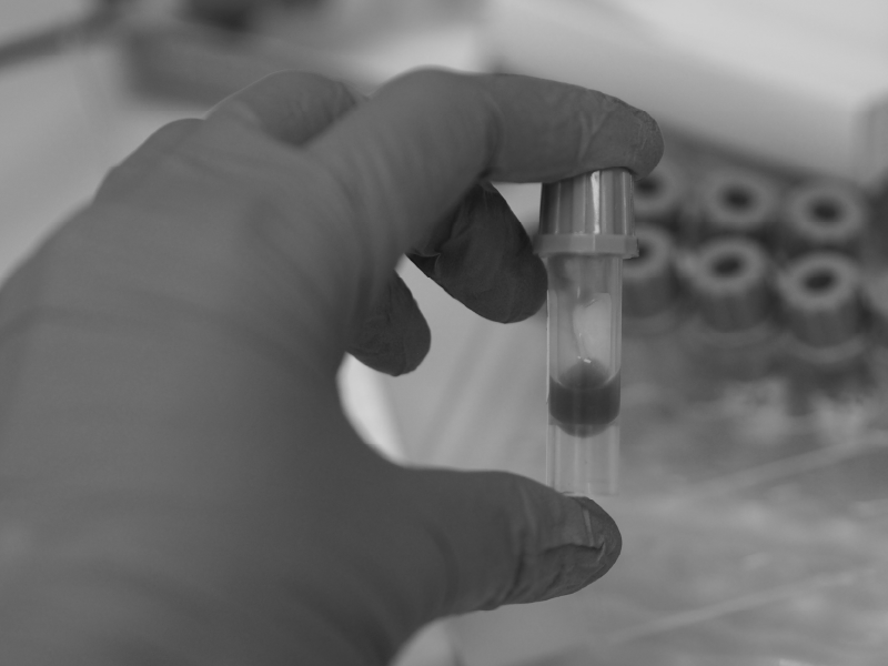Blood Smear Evaluation: The Basics