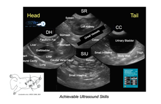 AFAST® and Its Abdominal Fluid Scoring System