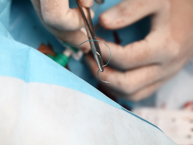 W0145_Tile "Oh Sew Easy" - Understanding Suture Materials
